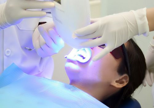 Phương pháp tẩy trắng răng giúp bạn tự tin hơn 1