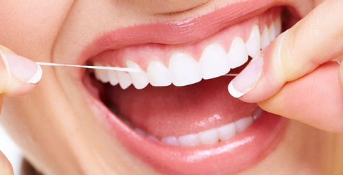 Các loại niềng răng thẩm mỹ hiện nay 2 Các loại niềng răng thẩm mỹ hiện nay 2