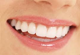 Tẩy trắng răng giúp bạn tự tin và tươi trẻ