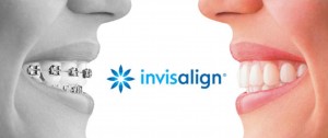 Các vấn đề khi niềng răng