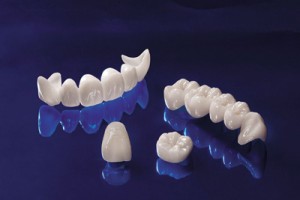 Cấu tạo của chiếc răng giả bằng sứ 