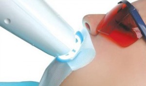 Làm trắng răng bằng cách nào để hiệu quả nhất?