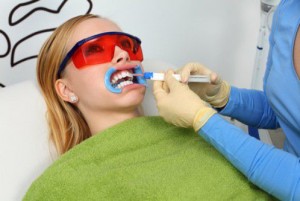 Quy trình đầy đủ của tẩy trắng răng tại nha khoa 