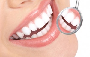 Tẩy trắng răng bằng laser có nhanh không? 
