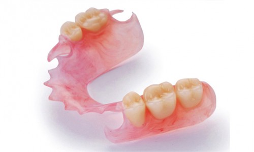 Nên cấy ghép Implant hay hàm giả cầu răng ?