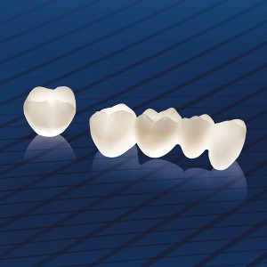 Cách khắc phục răng nhiễm Tetracycline 3