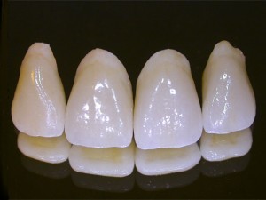 Các vật liệu kim loại làm răng giả trong nha khoa