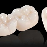 Quy trình làm răng sứ Zirconia