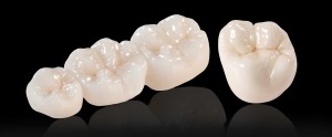 Quy trình làm răng sứ Zirconia