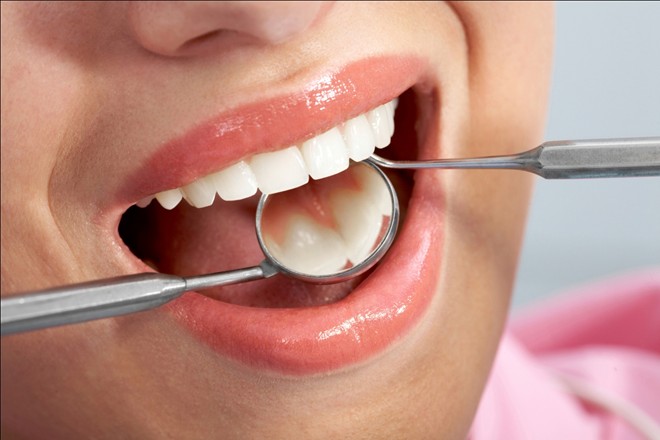 Dịch vụ chỉnh răng và điều cần lưu ý