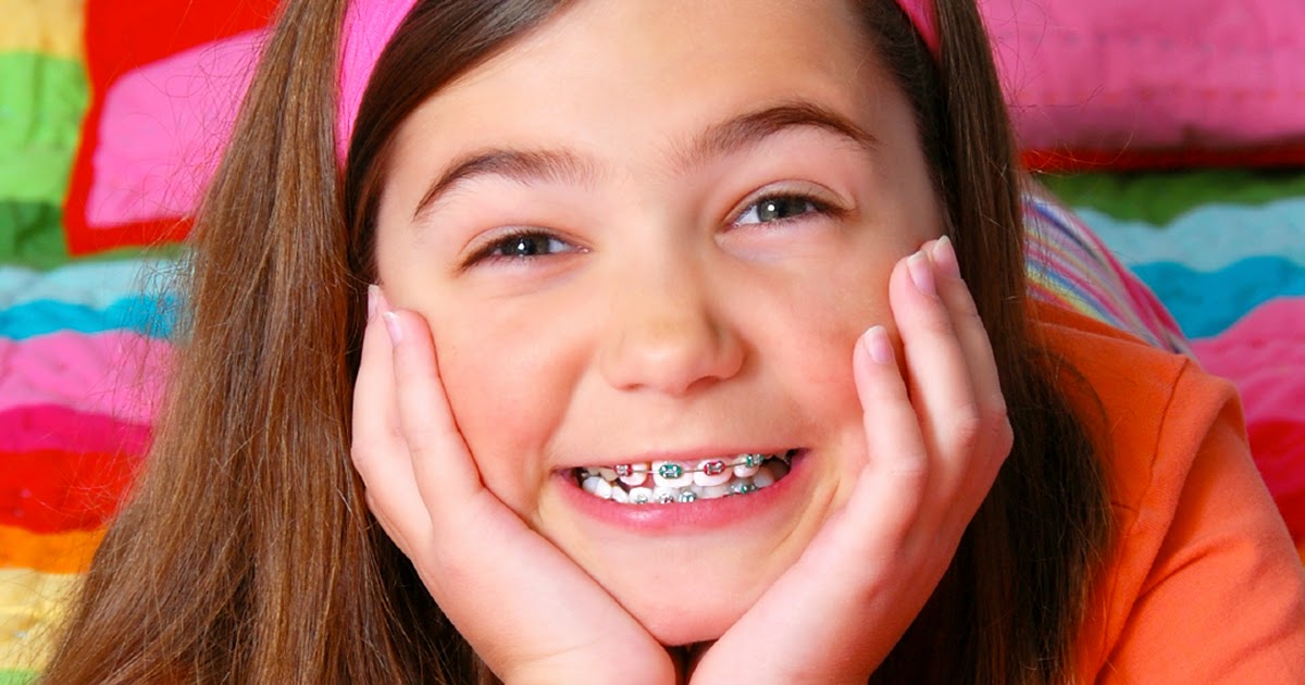 Phương pháp niềng răng không nhổ răng cho trẻ em
