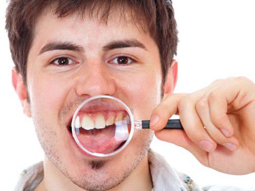Phòng ngừa viêm chân răng implant như thế nào ?
