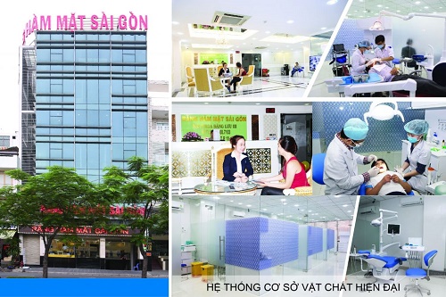 Implant sau nhổ răng 3 Implant sau nhổ răng 3