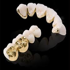 Răng sứ kim loại và không kim loại khác nhau 1 Răng sứ kim loại và không kim loại khác nhau 1