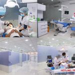 Bật mí 3 cách để có địa chỉ trồng răng implant tốt uy tín