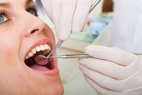 Mọc răng khôn uống thuốc gì để giảm thiểu đau sưng răng? 3