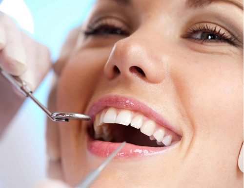 Phương pháp nhổ răng khôn không đau 2