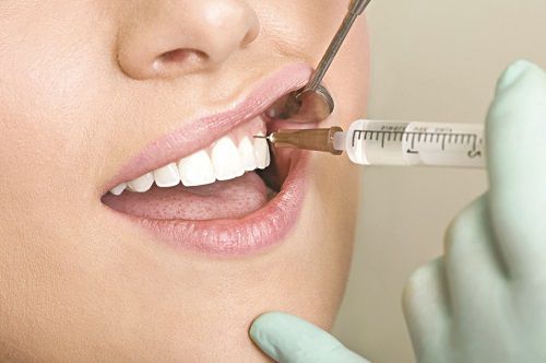 Khi răng khôn bị sâu có nên nhổ không? 3
