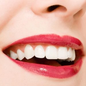 Tìm hiểu trồng răng để biết trồng răng sứ giá bao nhiêu 1
