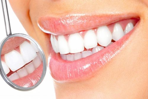 Bọc răng sứ cho răng bị thưa có giữ lâu được không? 2