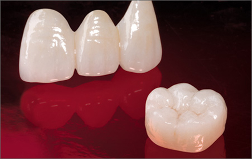 Phương pháp bọc răng sứ có tác hại gì không? 3