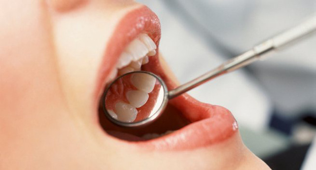 Chảy máu chân răng là biểu hiện của bệnh gì sắp đến? 2