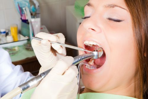 Nhổ răng khểnh có đau không? 3