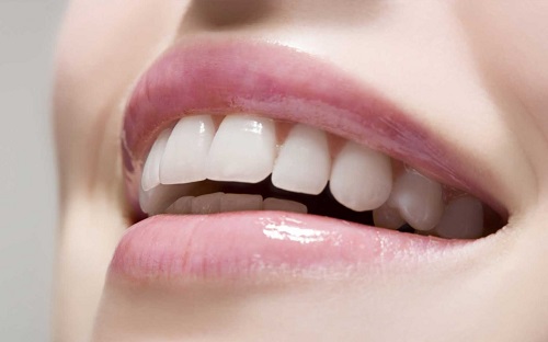 3 tác hại của việc tẩy trắng răng bạn nên biết 1