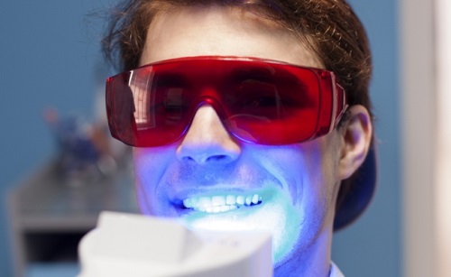 Tẩy trắng răng bằng đèn plasma giá bao nhiêu? 3