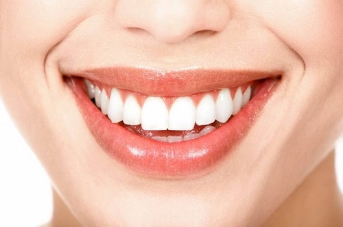 Trám răng hàm trên được áp dụng cho trường hợp nào? 3