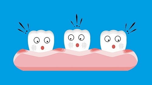 Theo bạn có nên tẩy trắng răng nhiều lần không? 2