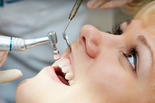 Lấy cao răng có đau hay không? Cần tư vấn 3