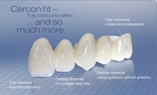 Bọc răng sứ cercon - Những ưu và nhược điểm nổi bật-1