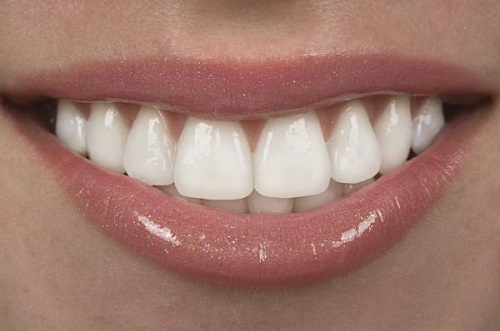 Bọc răng sứ chỉnh hô giải pháp hiệu quả an toàn-2