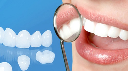 Bọc răng sứ có ảnh hưởng gì không? Tìm hiểu thông tin-1 Bọc răng sứ có ảnh hưởng gì không? Tìm hiểu thông tin-1