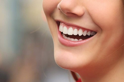 Bọc răng sứ không cần mài răng có hiệu quả không?-4 Bọc răng sứ không cần mài răng có hiệu quả không?-4