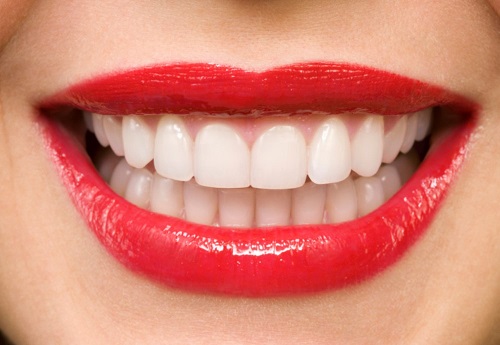 Bọc răng sứ ở đâu đẹp? Dựa vào các tiêu chí nào?-1 Bọc răng sứ ở đâu đẹp? Dựa vào các tiêu chí nào?-1