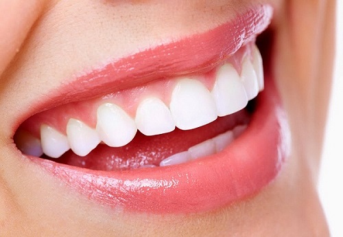 Bọc răng sứ titan có tốt không? Câu trả lời chính xác nhất-4 Bọc răng sứ titan có tốt không? Câu trả lời chính xác nhất-4