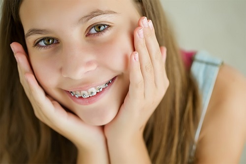 Niềng răng có hại gì không? Sức khỏe nha khoa-2