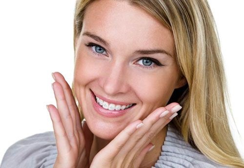 Niềng răng cửa bị mọc lệch cải thiện thẩm mỹ-4 Niềng răng cửa bị mọc lệch cải thiện thẩm mỹ-4