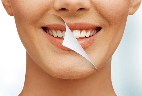 Tẩy trắng răng có được uống bia không? Tư vấn từ chuyên gia 1 Tẩy trắng răng có được uống bia không? Tư vấn từ chuyên gia 1