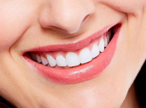 Chỉnh răng đều không cần niềng mang lại kết quả thế nào?-4 Chỉnh răng đều không cần niềng mang lại kết quả thế nào?-4