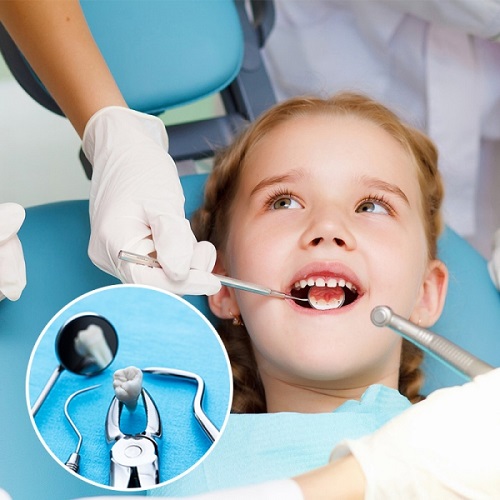 Niềng răng trẻ em bao nhiêu tiền? Chi phí ưu đãi tại nha khoa-3