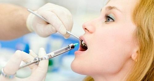Bọc răng chữa móm có được không? Nha khoa tư vấn-3