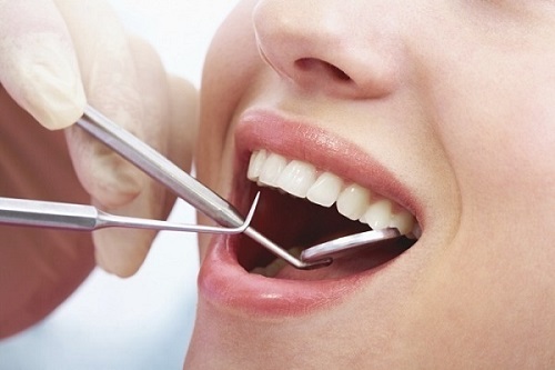 Bọc răng sứ có an toàn không? 3 lưu ý khi bọc răng sứ-3
