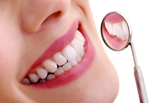 Răng sứ titan có mấy loại phổ biến nhất hiện nay?-3
