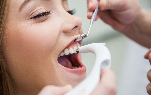 Răng sứ có đính đá được không? Chuyên mục thẩm mỹ nha khoa-3 Răng sứ có đính đá được không? Chuyên mục thẩm mỹ nha khoa-3