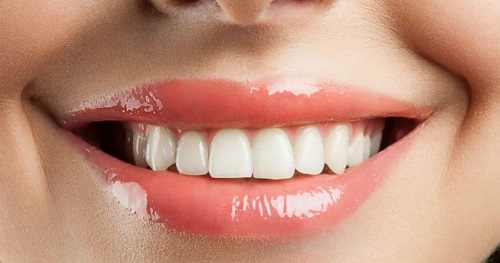 Trồng răng có ảnh hưởng gì không? Tìm hiểu ngay 1