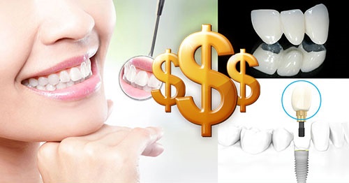 Trồng răng cấm hết bao nhiêu tiền? Mức chi phí phù hợp 3 Trồng răng cấm hết bao nhiêu tiền? Mức chi phí phù hợp 3