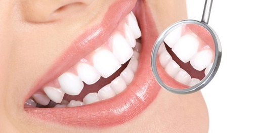 Trồng răng giả có đau không? Kiến thức cần biết khi trồng răng 4 Trồng răng giả có đau không? Kiến thức cần biết khi trồng răng 4
